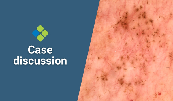 case discussion