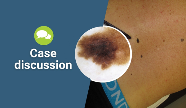 case discussion