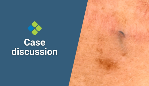 case discussion