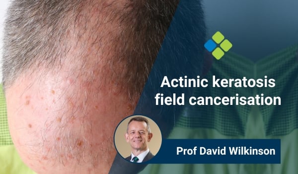 actinic keratosis