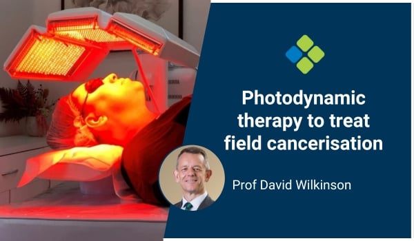 photodynamic therapy