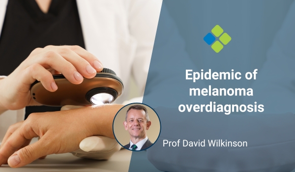 melanoma overdiagnosis