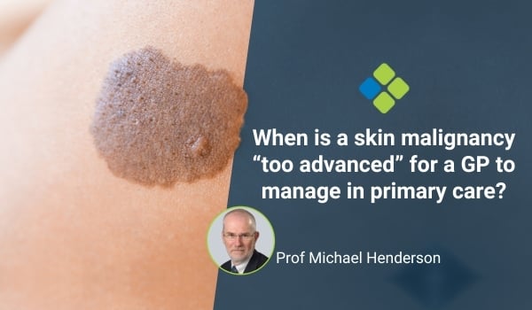 when is skin cancer too advanced?