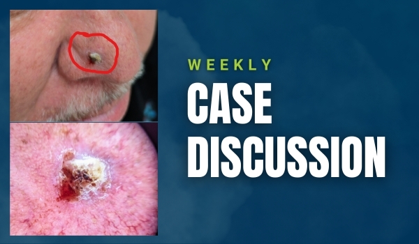case discussion