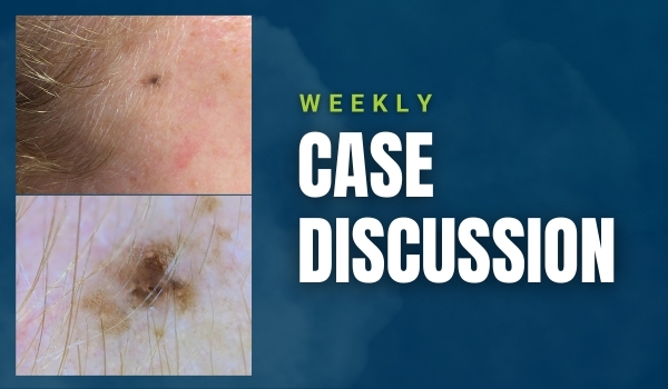 case discussion