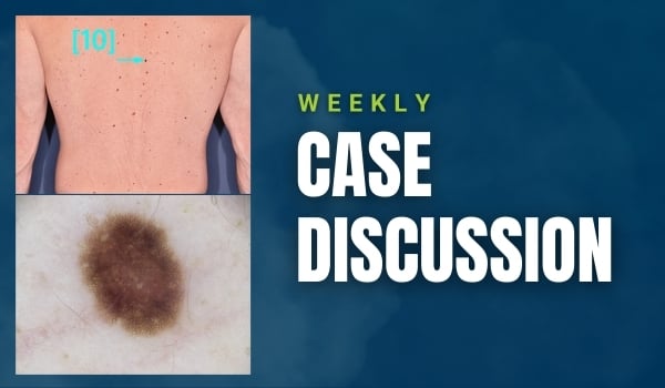 case discussion