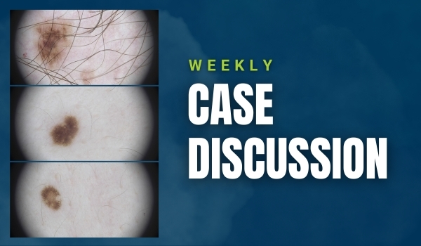 case discussion