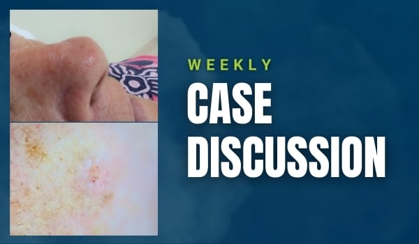 case discussion