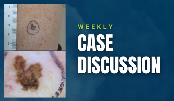 case discussion