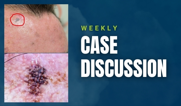 case discussion
