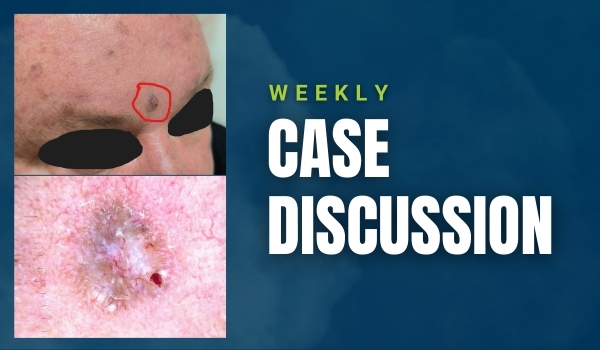 case discussion