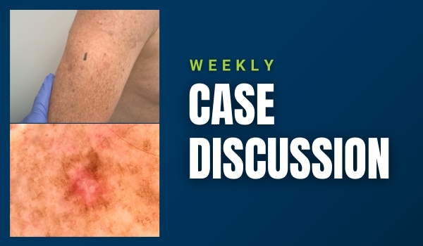 case discussion