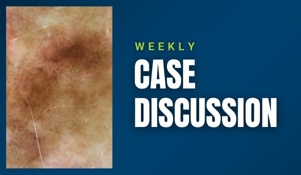 case discussion