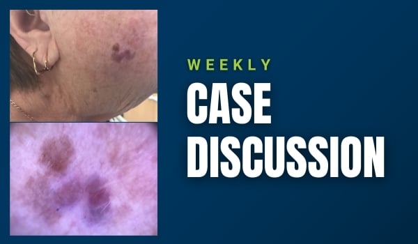 case discussion