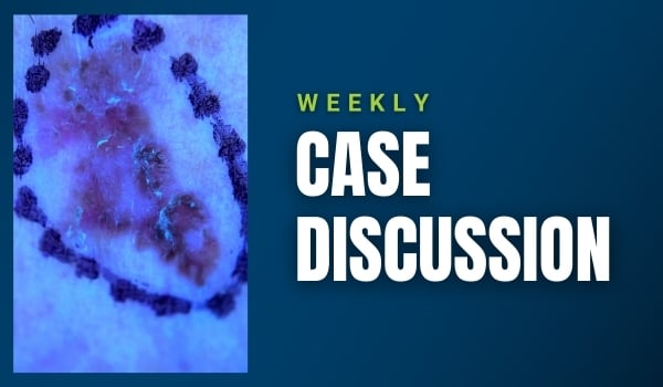 case discussion