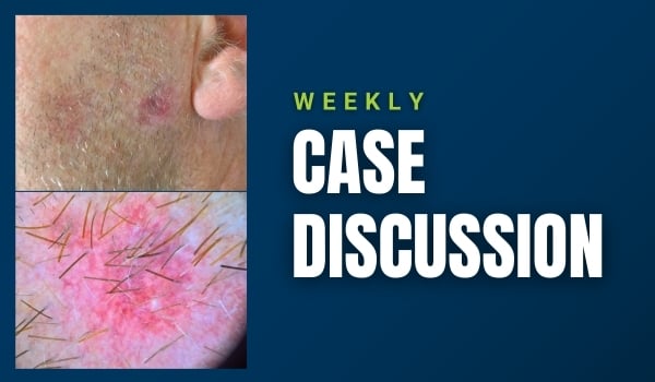 case discussion