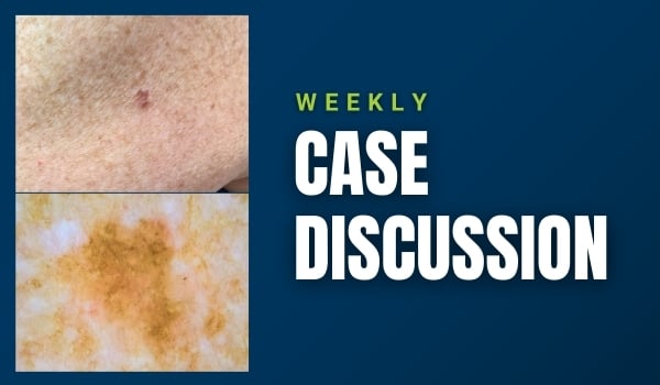 case discussion