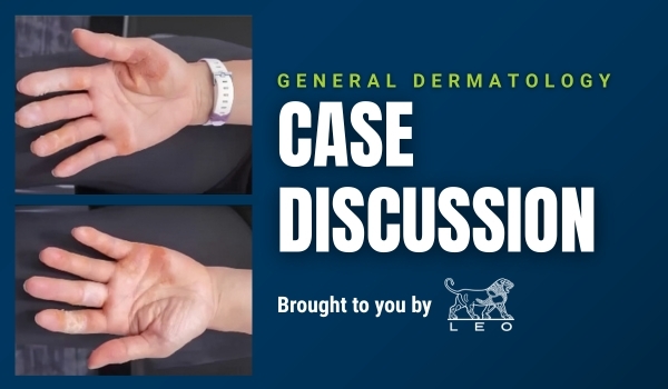 case discussion