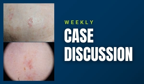 case discussion