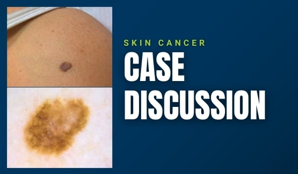 case discussion