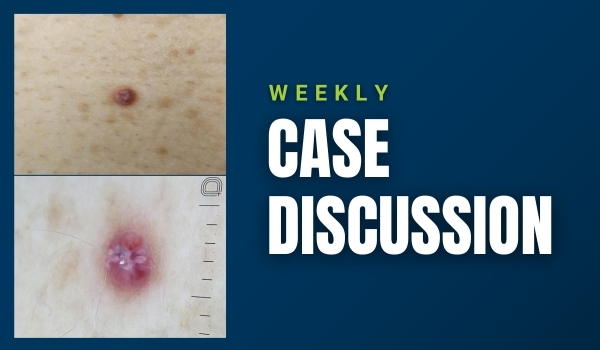 case discussion