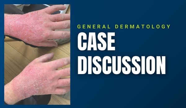 contact dermatitis case discussion