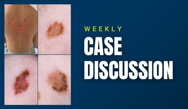 case discussion