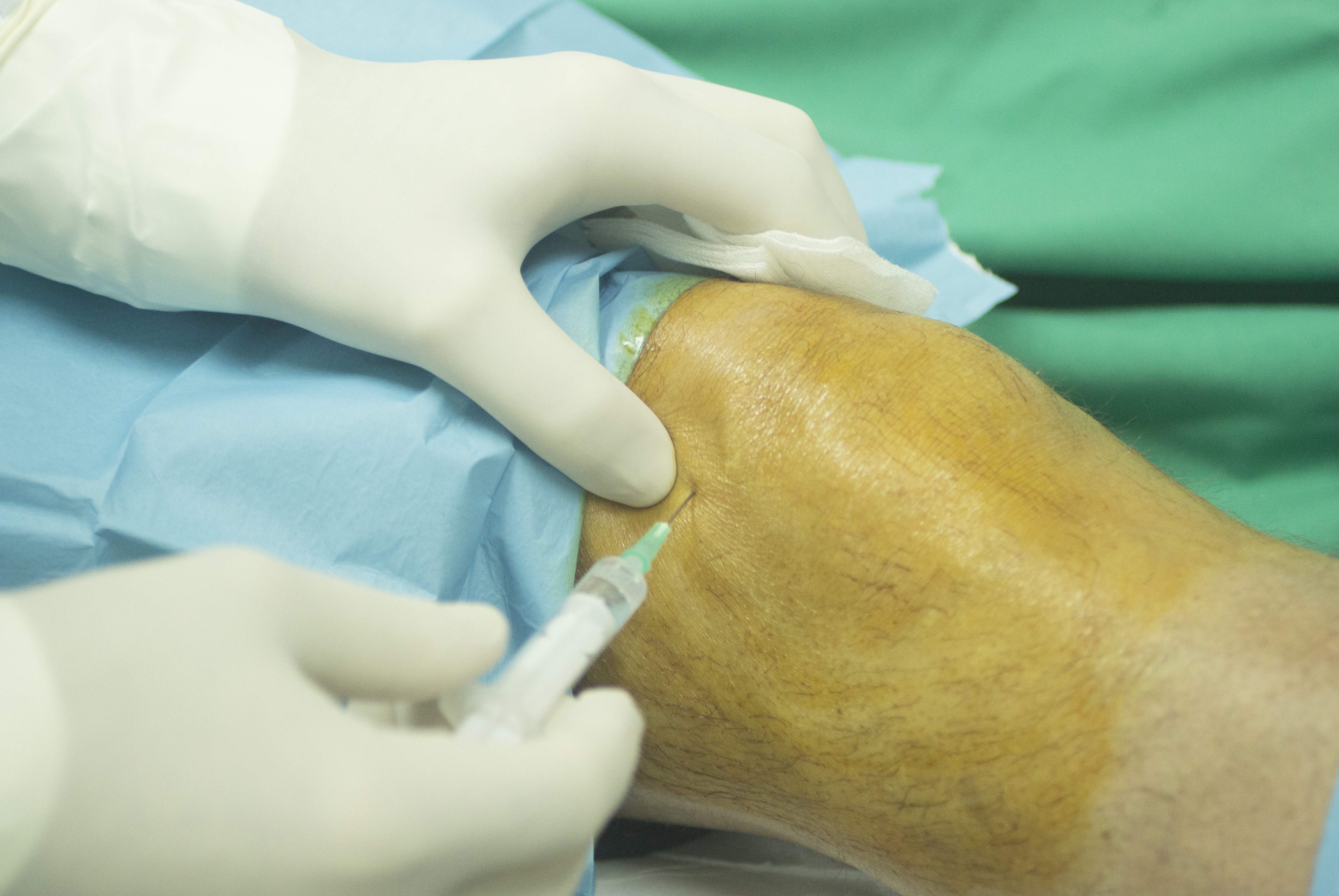 Advanced in Joint Puncture and Soft Tissue Injections