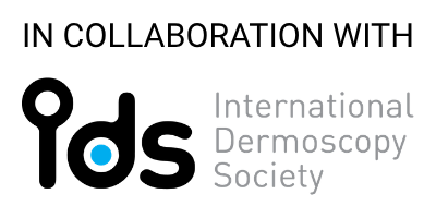 International Dermoscopy Society