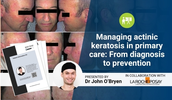 actinic keratosis