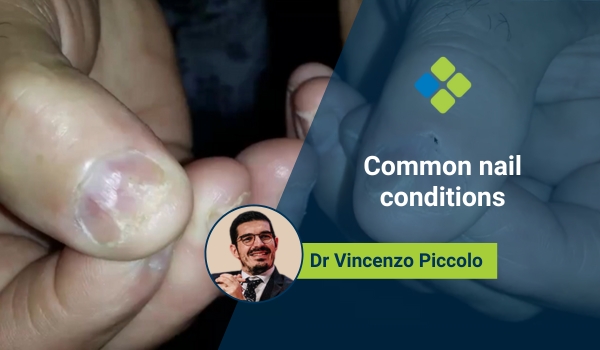 Diagnosing Common Skin Conditions of Dogs and Cats in Community Medicine  Practice | Today's Veterinary Practice