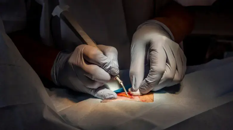 Case Studies for Skin Cancer Surgery
