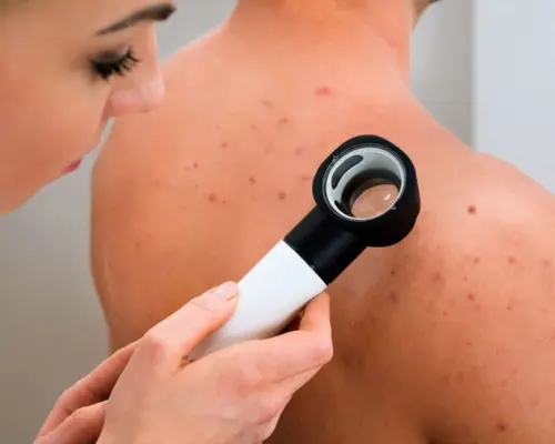 Professional Diploma of General Dermatology