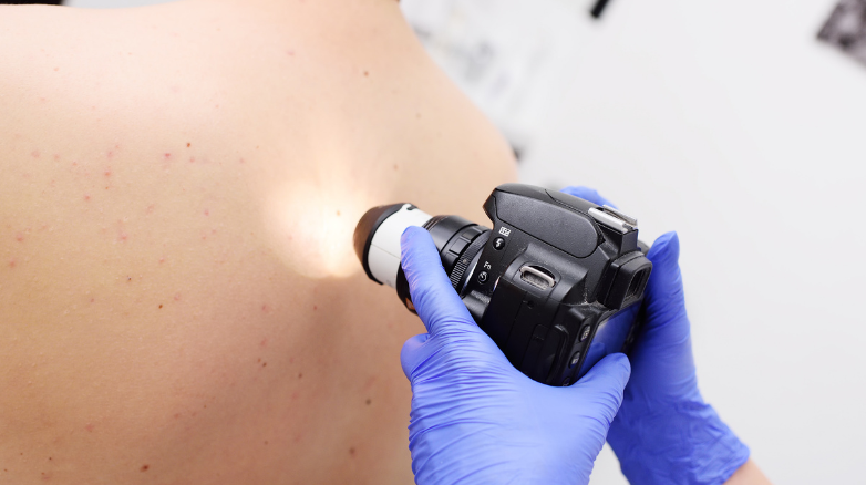 Skin imaging techniques (Nurses)