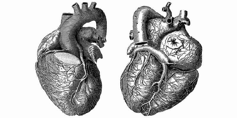 Atrial fibrillation
