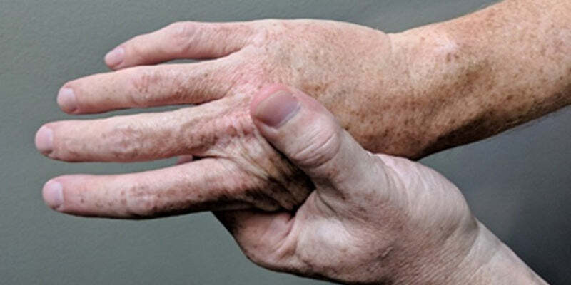 Inflammatory arthritis