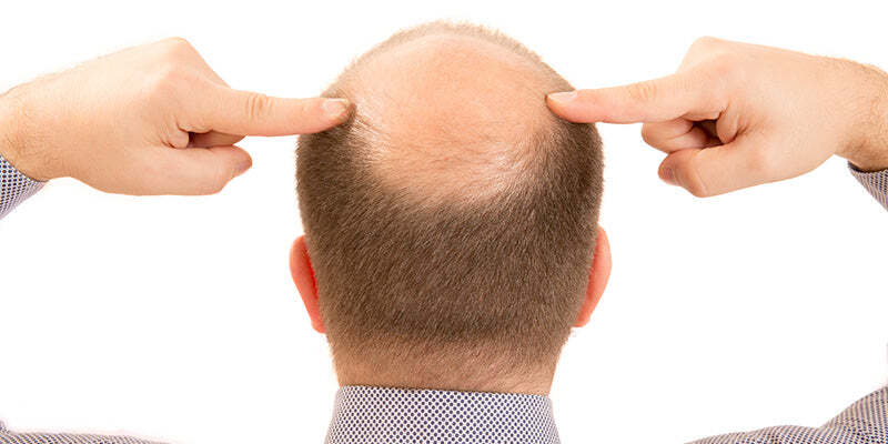 Male hair loss and genital inflammatory dermatoses