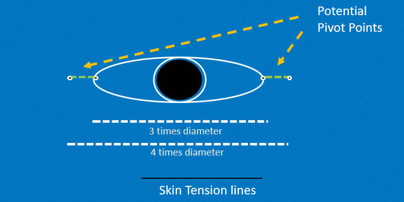Pivotal Flaps