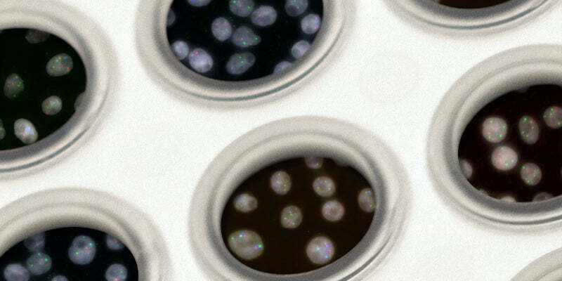 Premature Ovarian Insufficiency