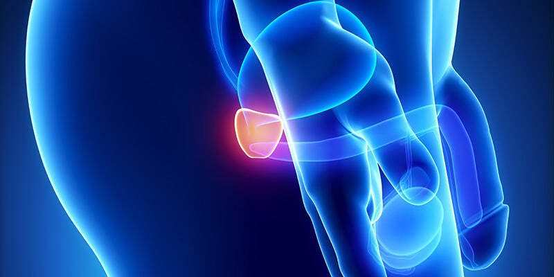 Prostate conditions and prostate check