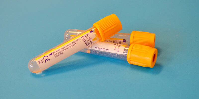 Sexually Transmitted Infections and Cervical Screening