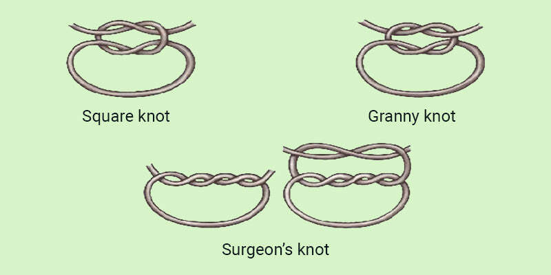 Suturing and perfecting the ellipse plus local anaesthetic