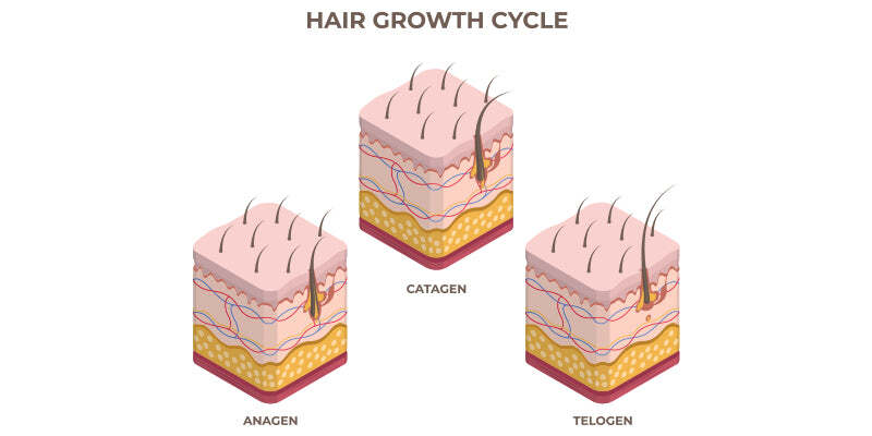 Telogen Effluvium